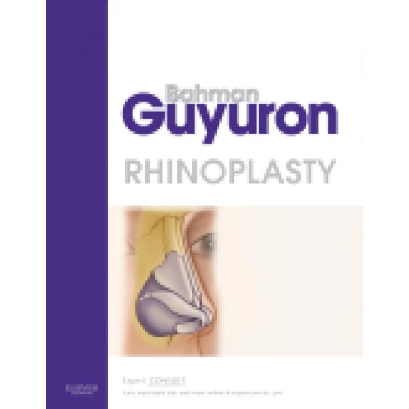 Rhinoplasty